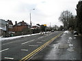 Speed camera on the A31 just past Agraria Road